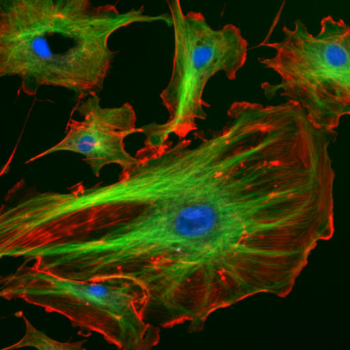 Komórki śródbłonka widoczne pod mikroskopem fluorescencyjnym. Fot. http://rsb.info.nih.gov/ij/images/Wikimedia