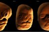 Rozwój embrionalny ludzkiej twarzy. Fot. BBC