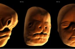 Rozwój embrionalny ludzkiej twarzy. Fot. BBC