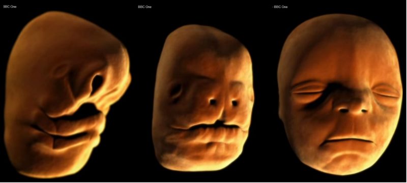 Rozwój embrionalny ludzkiej twarzy. Fot. BBC