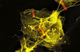 Batkerie z rodzaju Shigella uwięzione w sieci wytworzonej przez neutrofile. Fot. Max Planck Institute for Infection Biology