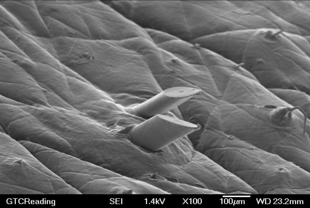 Ludzka skóra widziana w skaningowym mikroskopie elektronowym. Widać włosy gładko przecięte ostrzem maszynki. Ich wytrzymałość można porównać z miedzianymi drutami. Fot. P&G