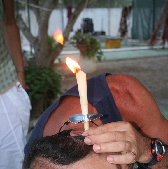 Zabieg świecowania uszu; Fot: Franciaio (CC BY-SA 3.0)